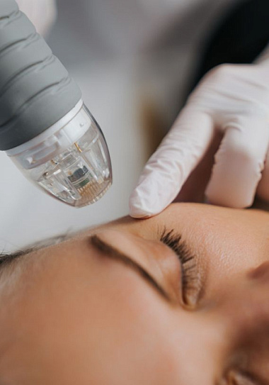 Скидка 20% на игольчатый RF-лифтинг!